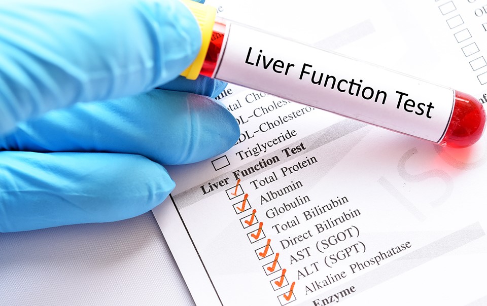Liver Function Tests: Purpose, Procedure, and Results